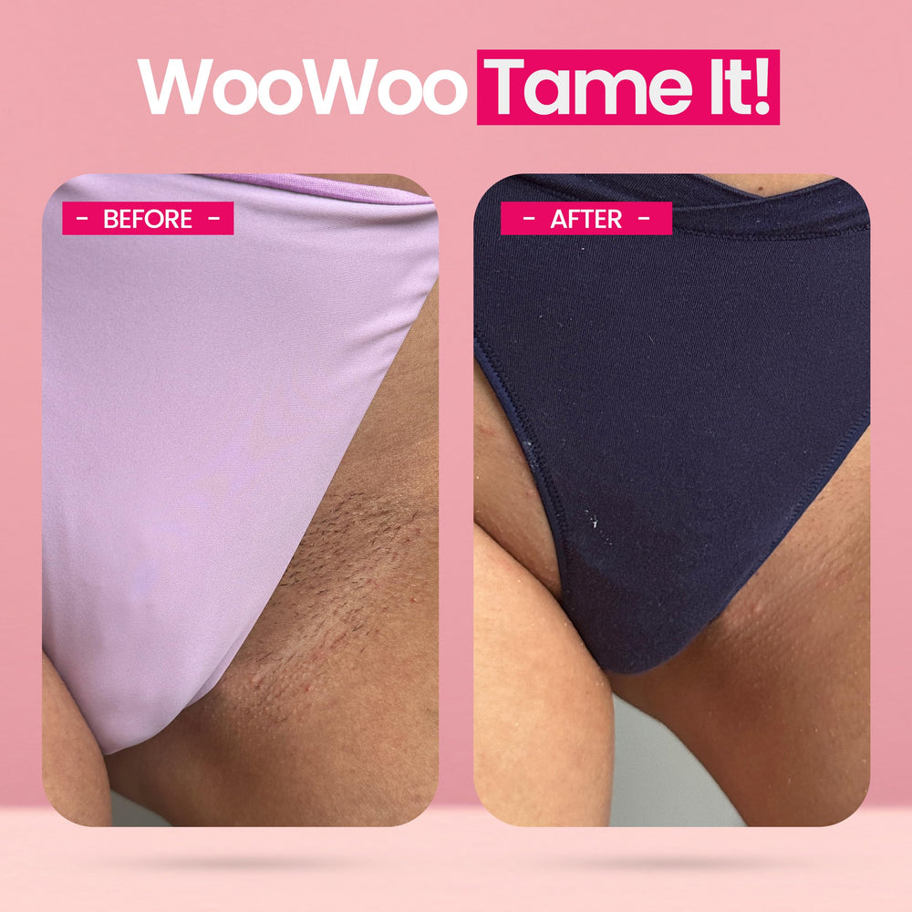 Woowoo Tame It Aloe Vera enriched formula soothing the skin