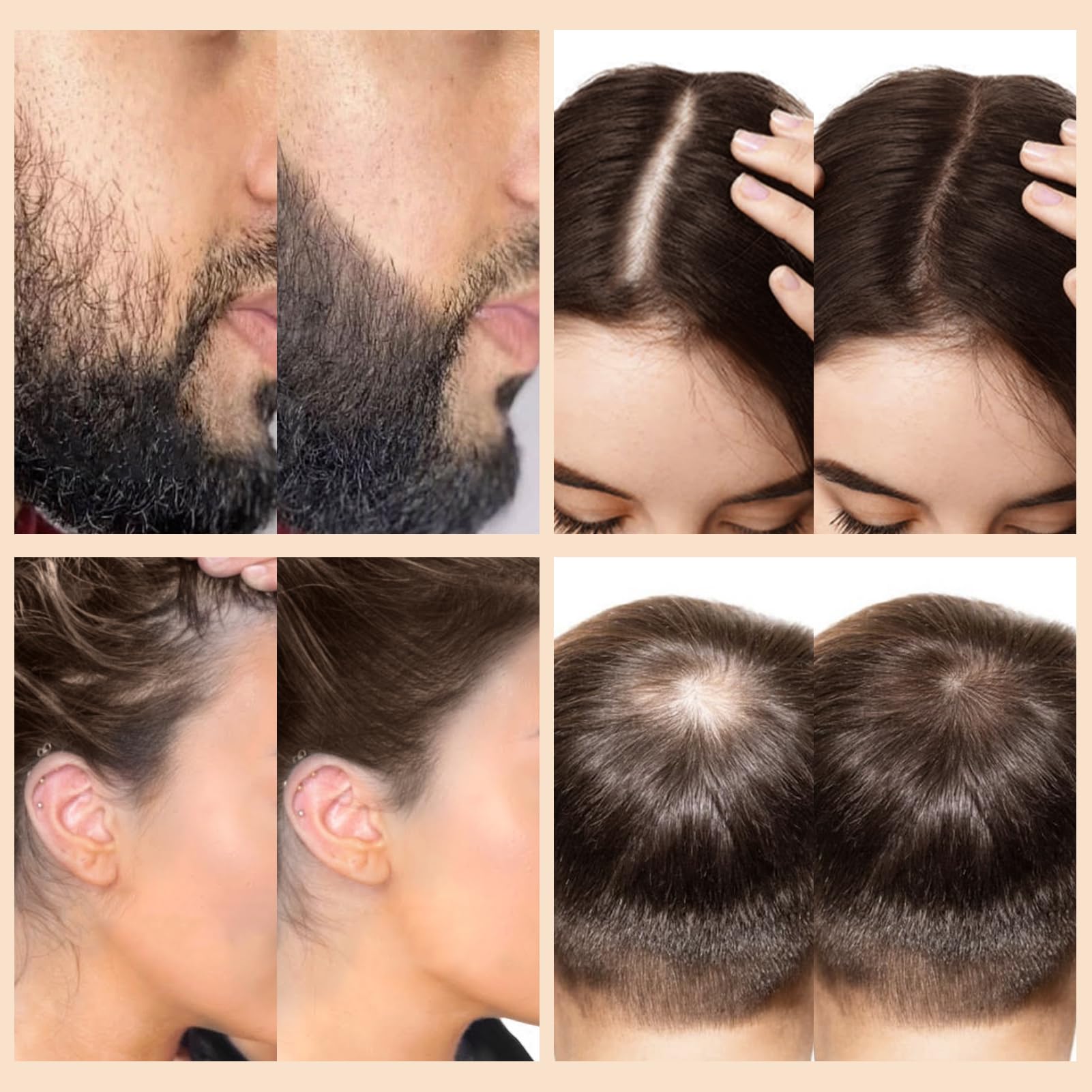 WOZUTUNT fórmula suave apta para todo tipo de cabello