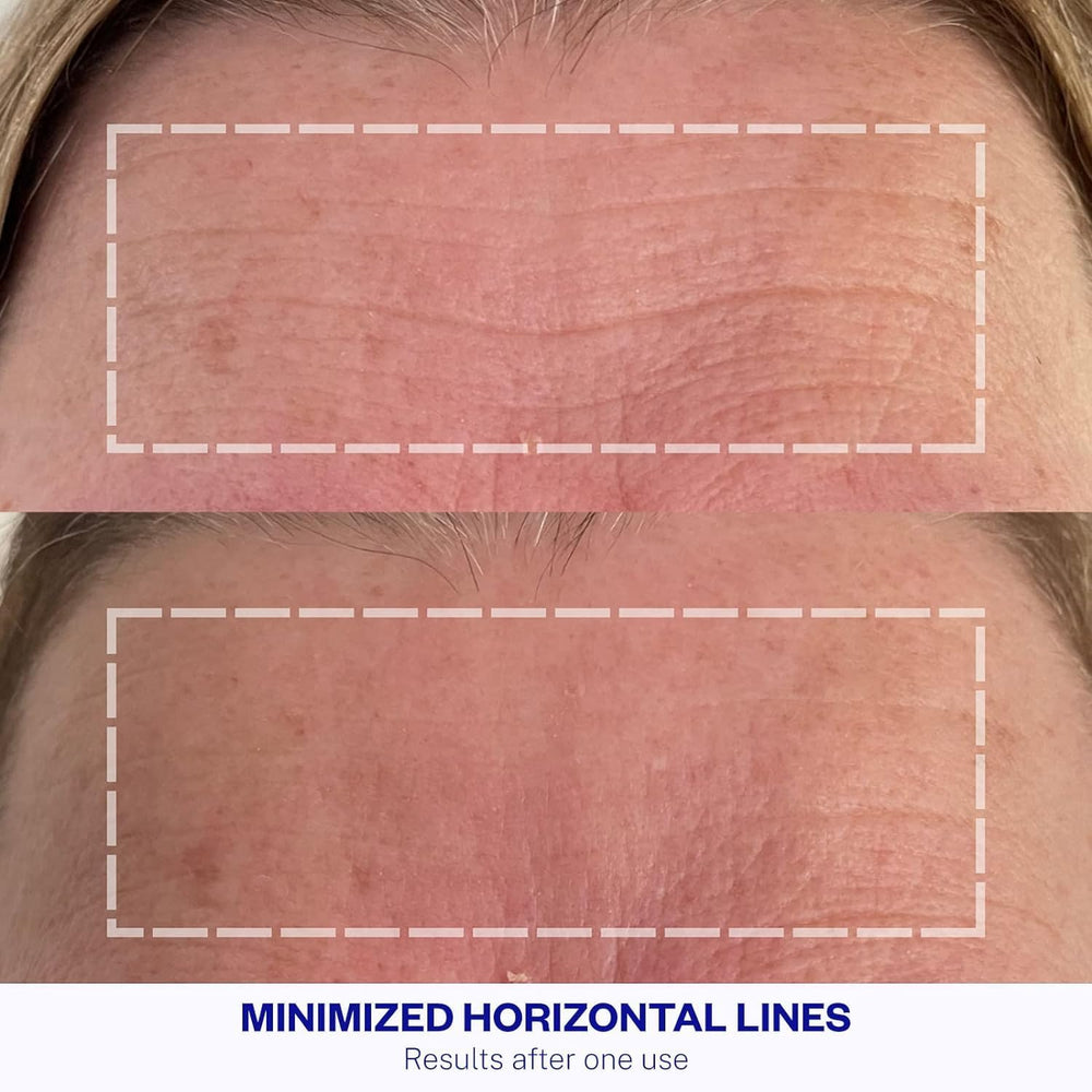 Wrinkles Schminkles Before After concept suggesting wrinkle reduction over time