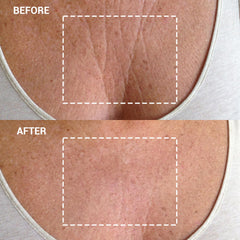 Soft medical‑grade silicone patch for chest care by Wrinkles Schminkles
