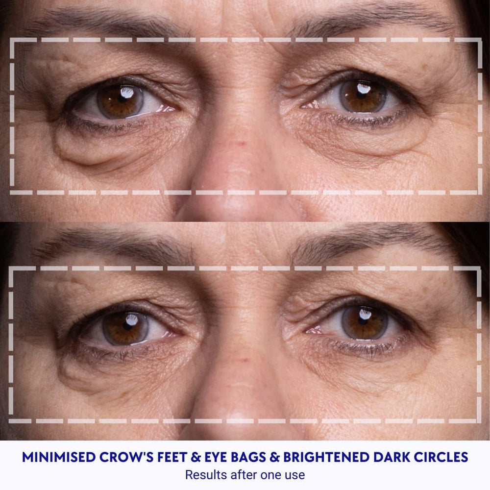 Wrinkles Schminkles Hydration boost graphic illustrating moisture support for skin