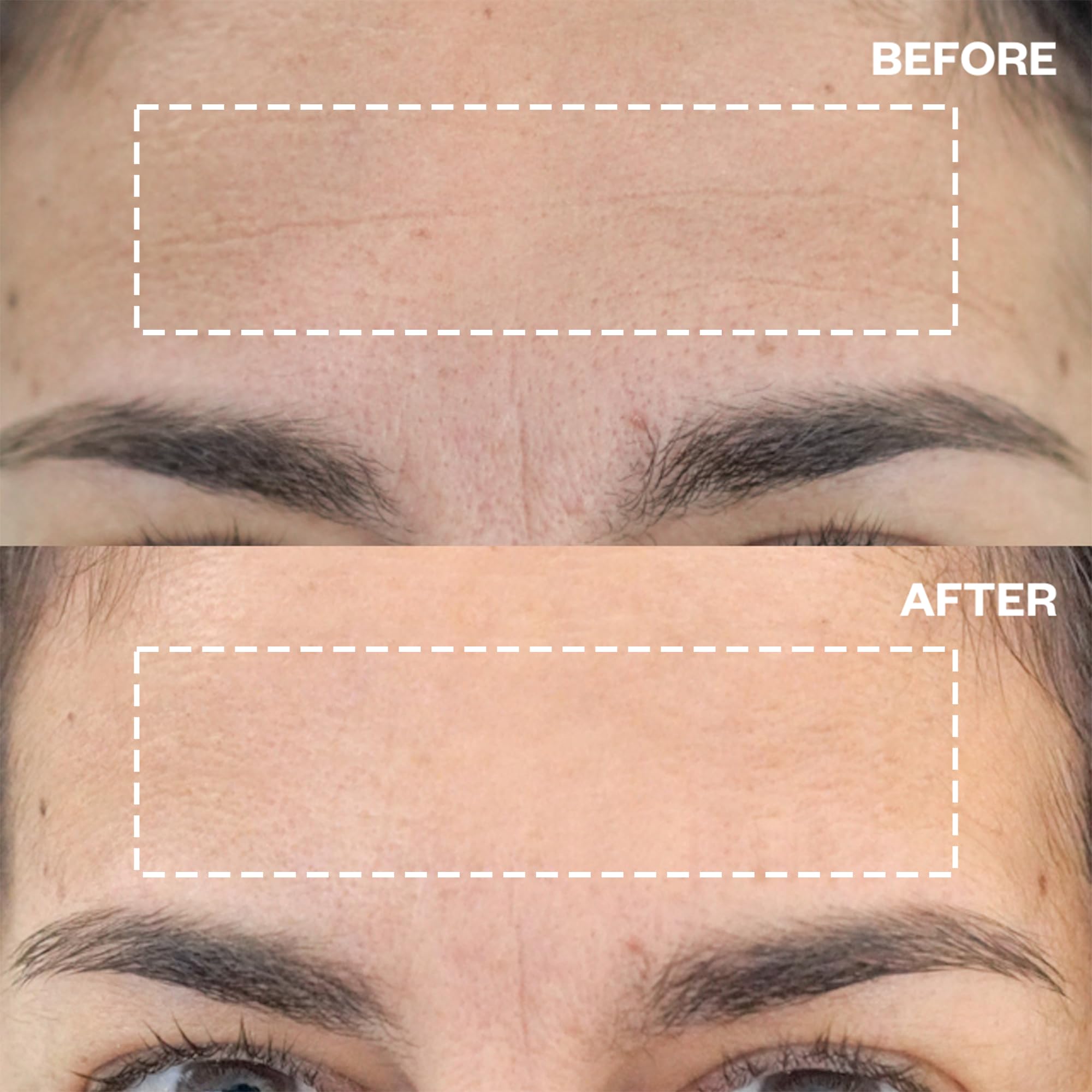 Wrinkles Schminkles night-use forehead patch demonstrates hydration potential