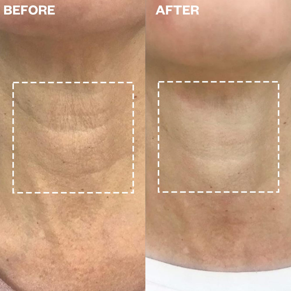 Wrinkles Schminkles neck patch is reusable for continued use.