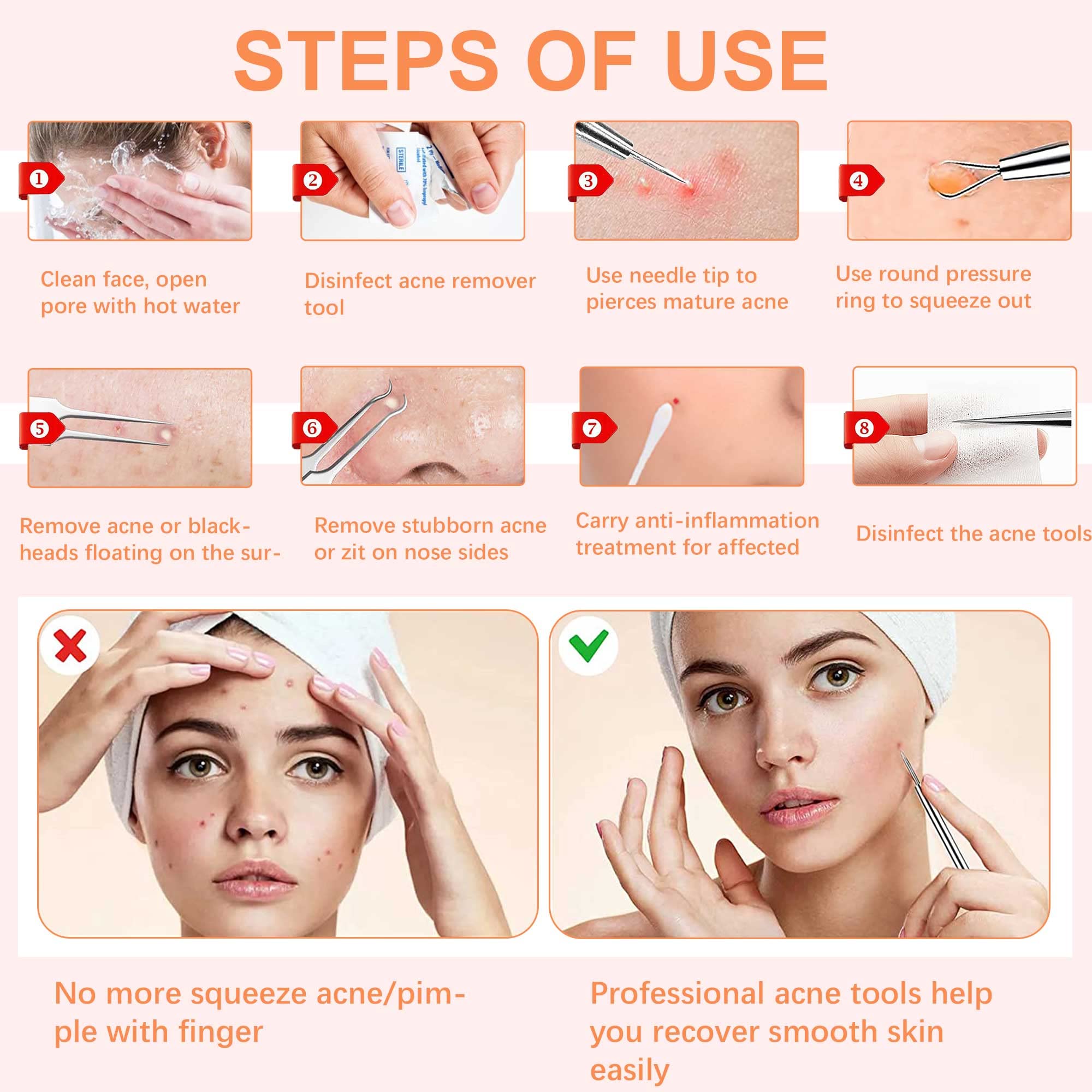 WSYUB blackhead extractor kit helps keep skin smooth and blemish-free.