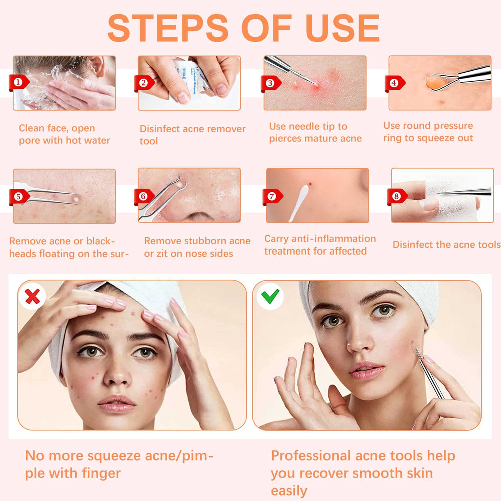 WSYUB blackhead extractor kit helps keep skin smooth and blemish-free.