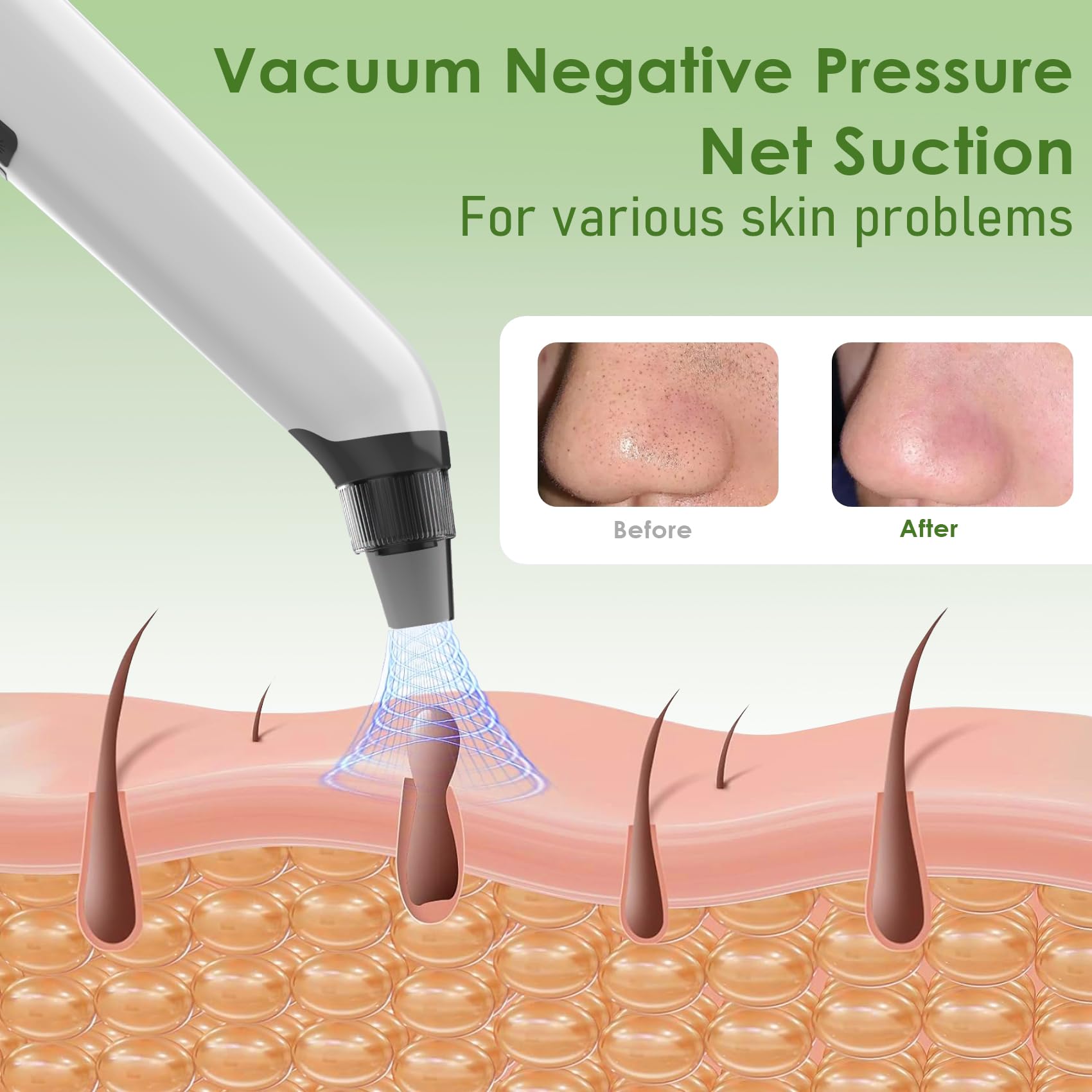 Xamoca Blackhead Remover Vacuum side view with slim portable design
