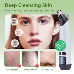 Xamoca interchangeable probes detail for targeted pore care