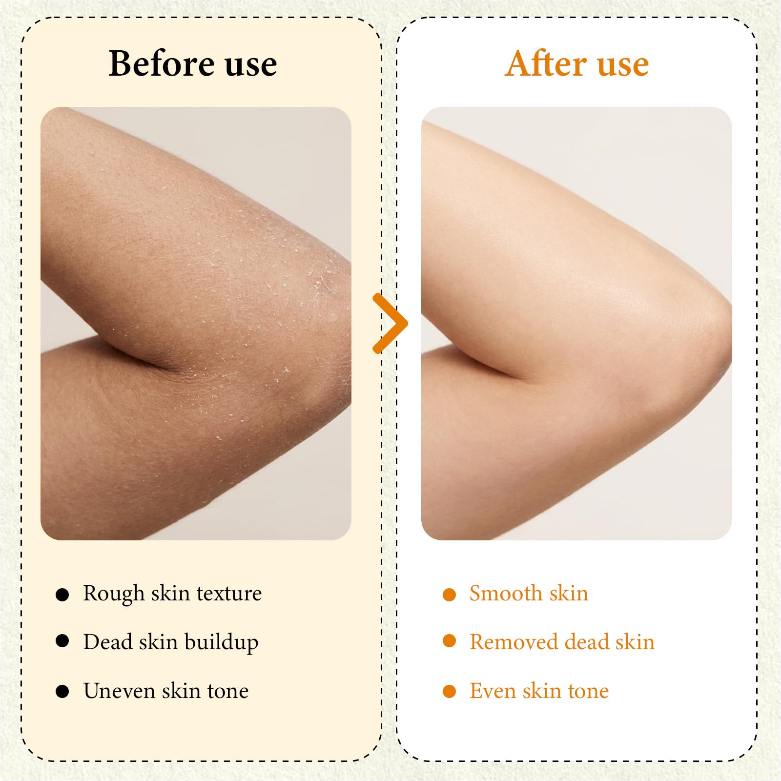 XILRVON Kojic Turmeric Spray y esponja exfoliante para zonas difíciles.