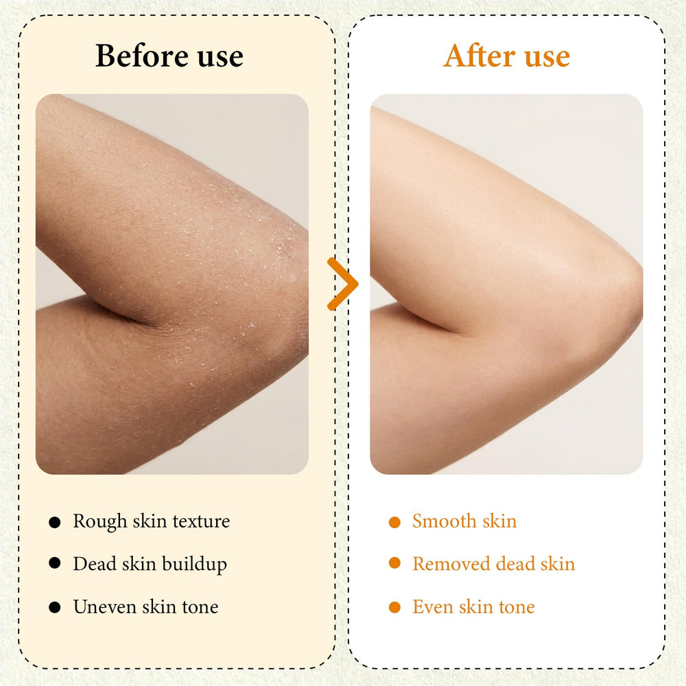 XILRVON Kojic Turmeric Spray y esponja exfoliante para zonas difíciles.