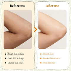 XILRVON Kojic Turmeric Spray y esponja exfoliante para zonas difíciles.