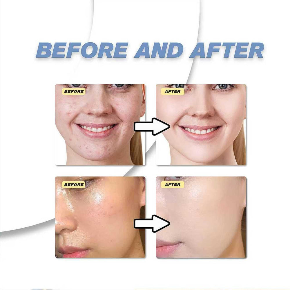 xinxinghualing formula helps balance skin oil, reducing shine without drying.