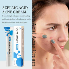 xinxinghualing azelaic acid cream formula includes hyaluronic acid for balanced hydration during use.