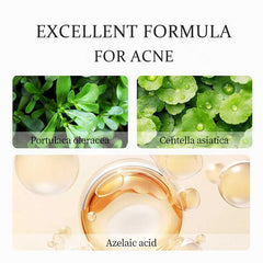 xinxinghualing azelaic acid cream texture swatch demonstrates smooth, fast-absorbing formula.