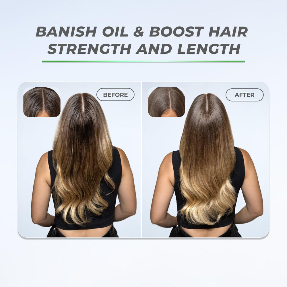 XMONDO Hair Boost X Dry Shampoo dermatologist-tested packaging close-up.