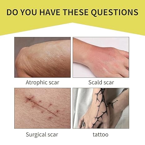 XUEVORIY: corte a medida para tatuajes grandes o pequeños.