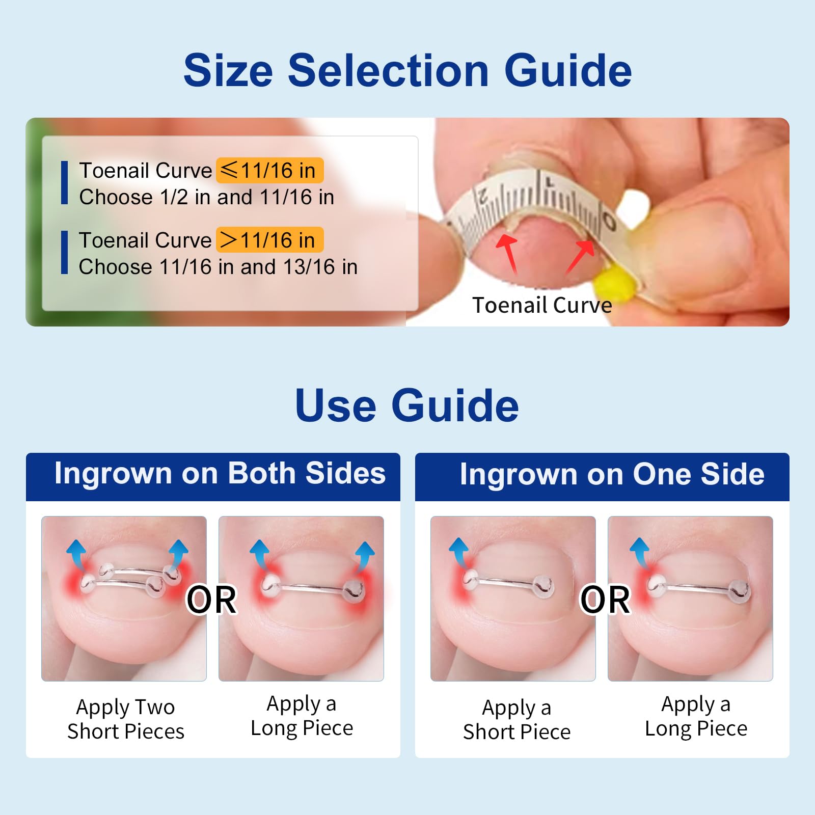 Yanxifei monthly corrector replacement supports ongoing management