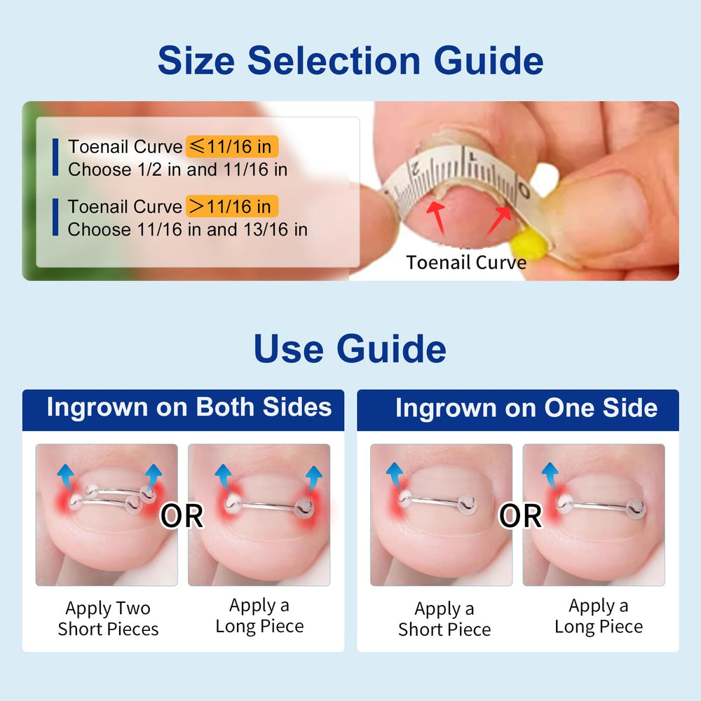 Yanxifei monthly corrector replacement supports ongoing management