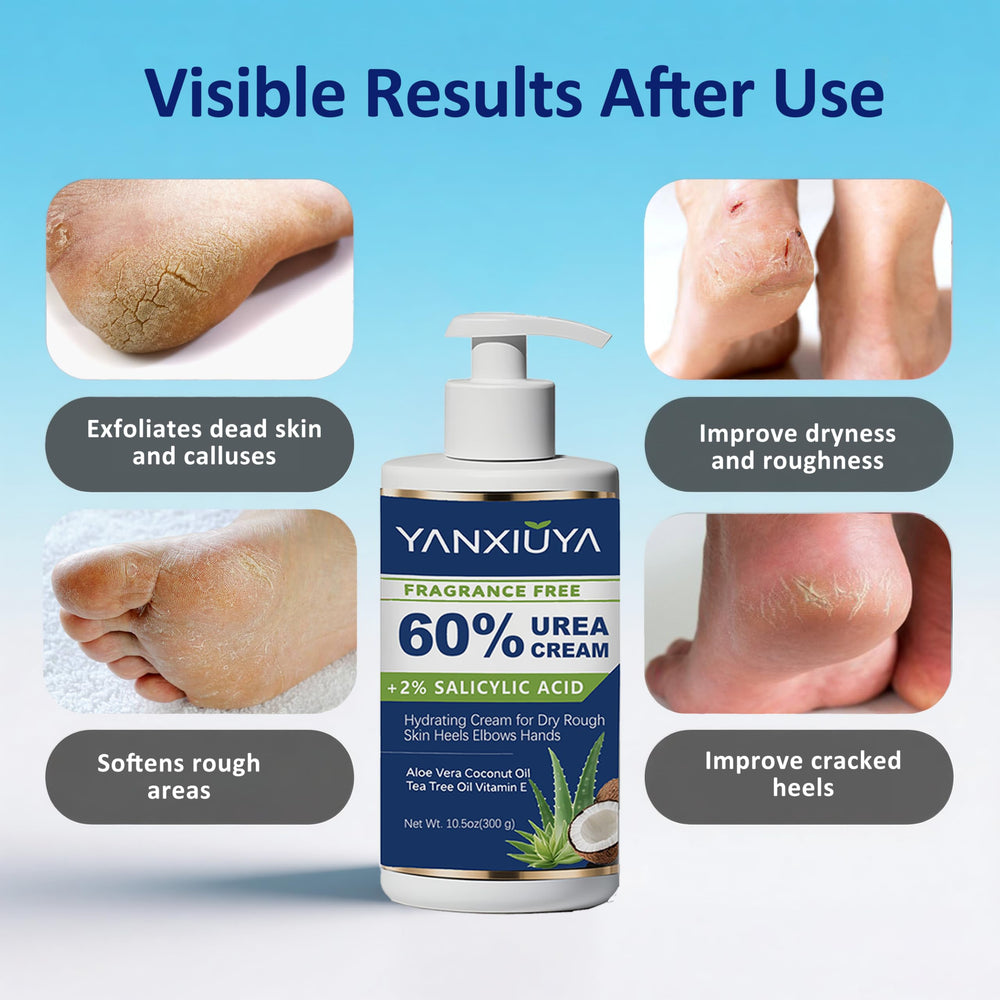 YANXIUYA Crema urea 60% para callos suaves en talones