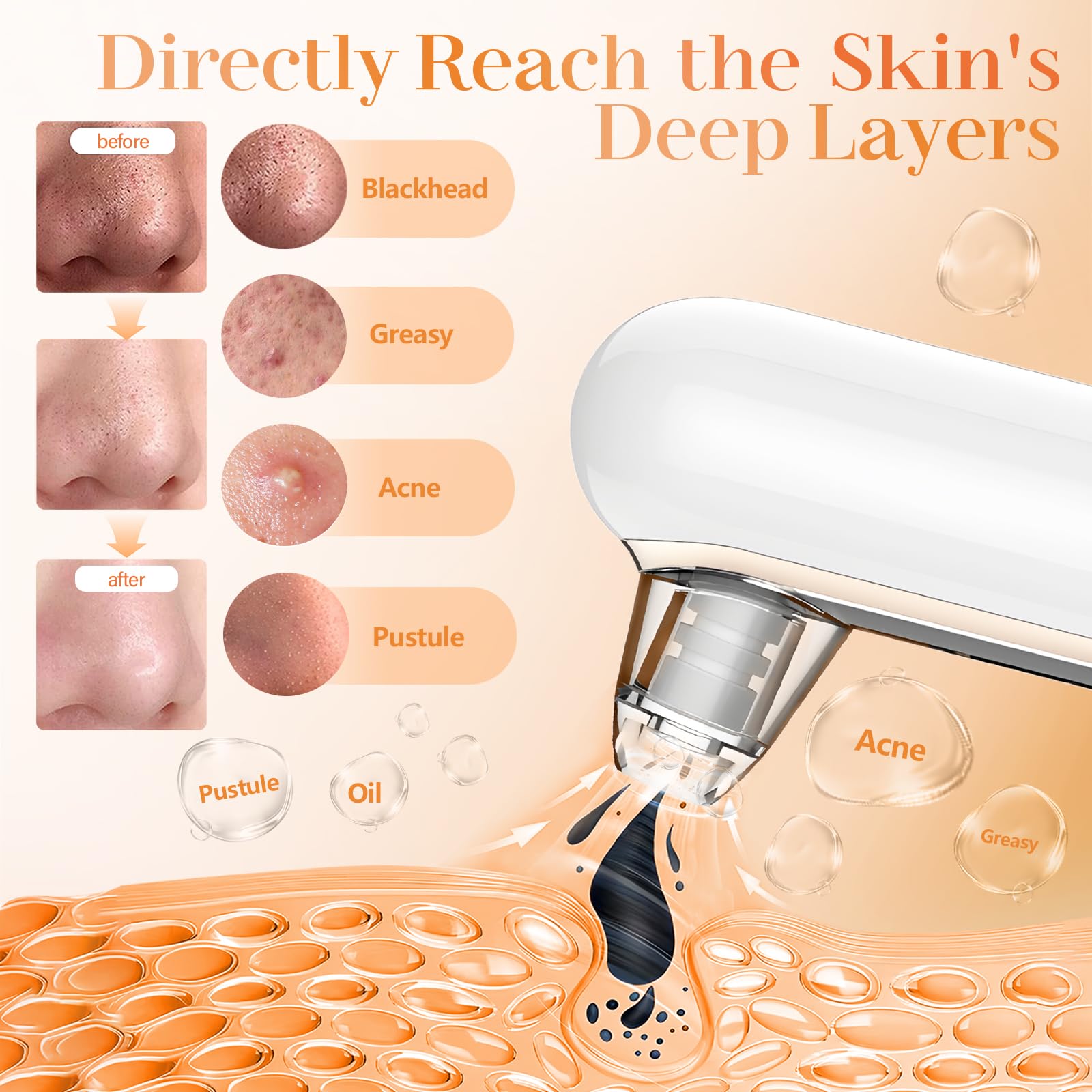 Yccu blackhead remover in action on nose for deep cleansing