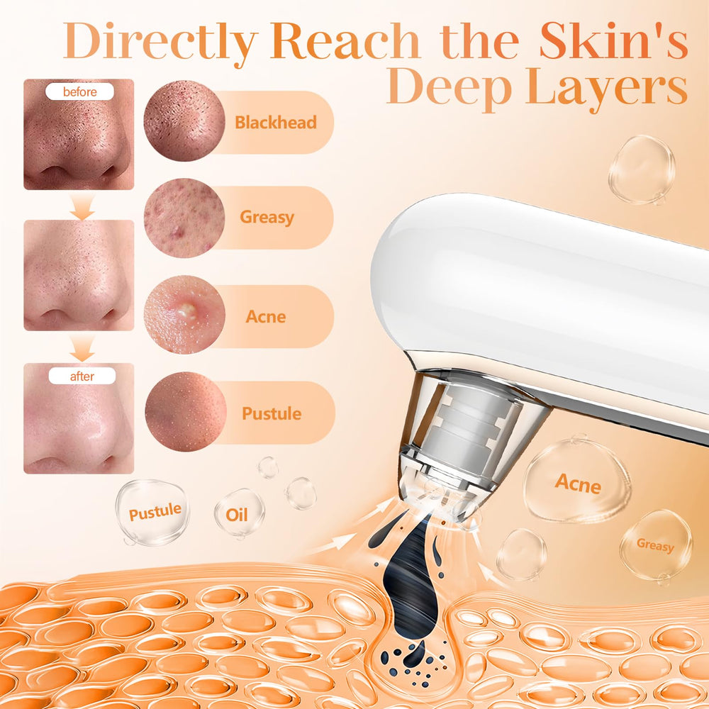 Yccu blackhead remover in action on nose for deep cleansing