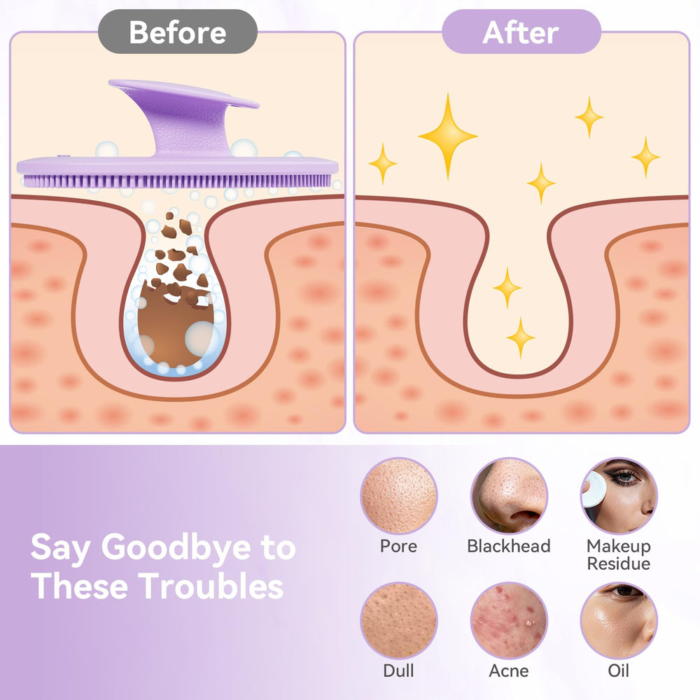 YEALIFE exfoliation-points aid mild exfoliation and facial massage