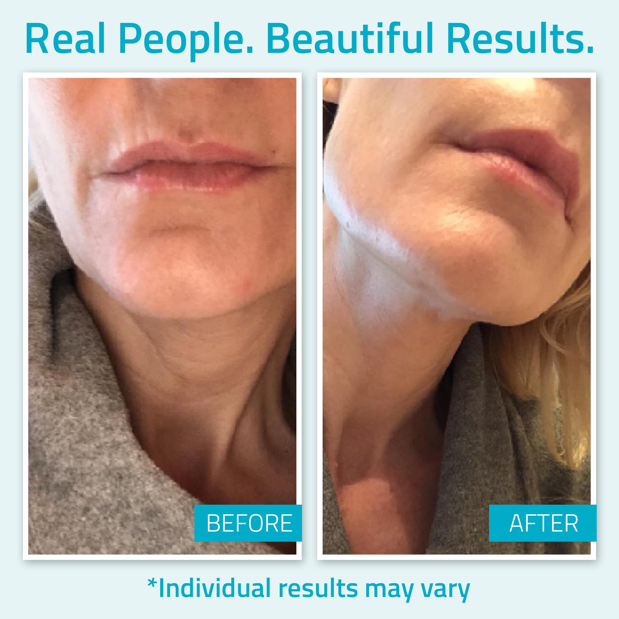YEOUTH copper-tripeptide-1 science illustration suggesting skin texture support.