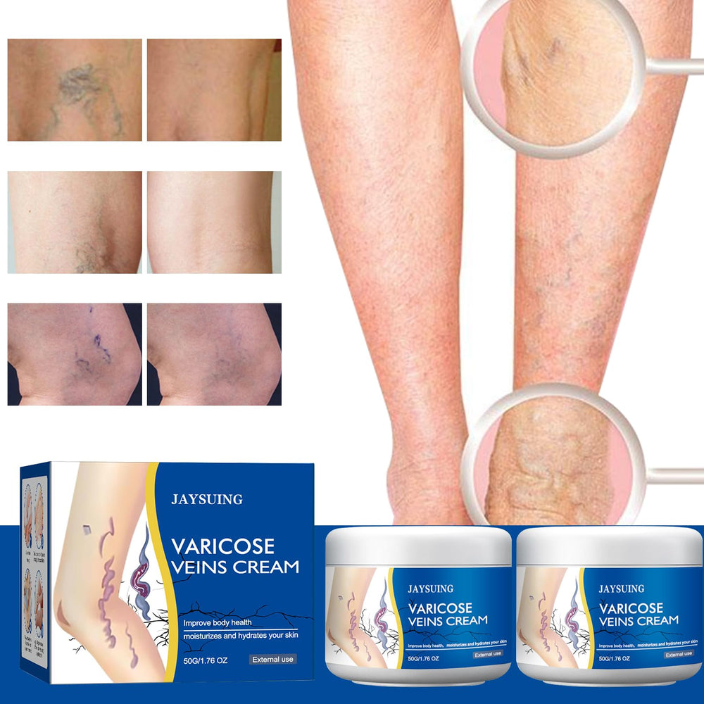Yetary crema para venas en piernas, enfoque de masaje para mejor absorción.
