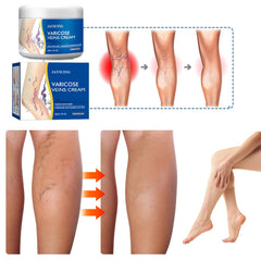 Yetary crema venas piernas, textura cremosa suave para nutrir la piel.