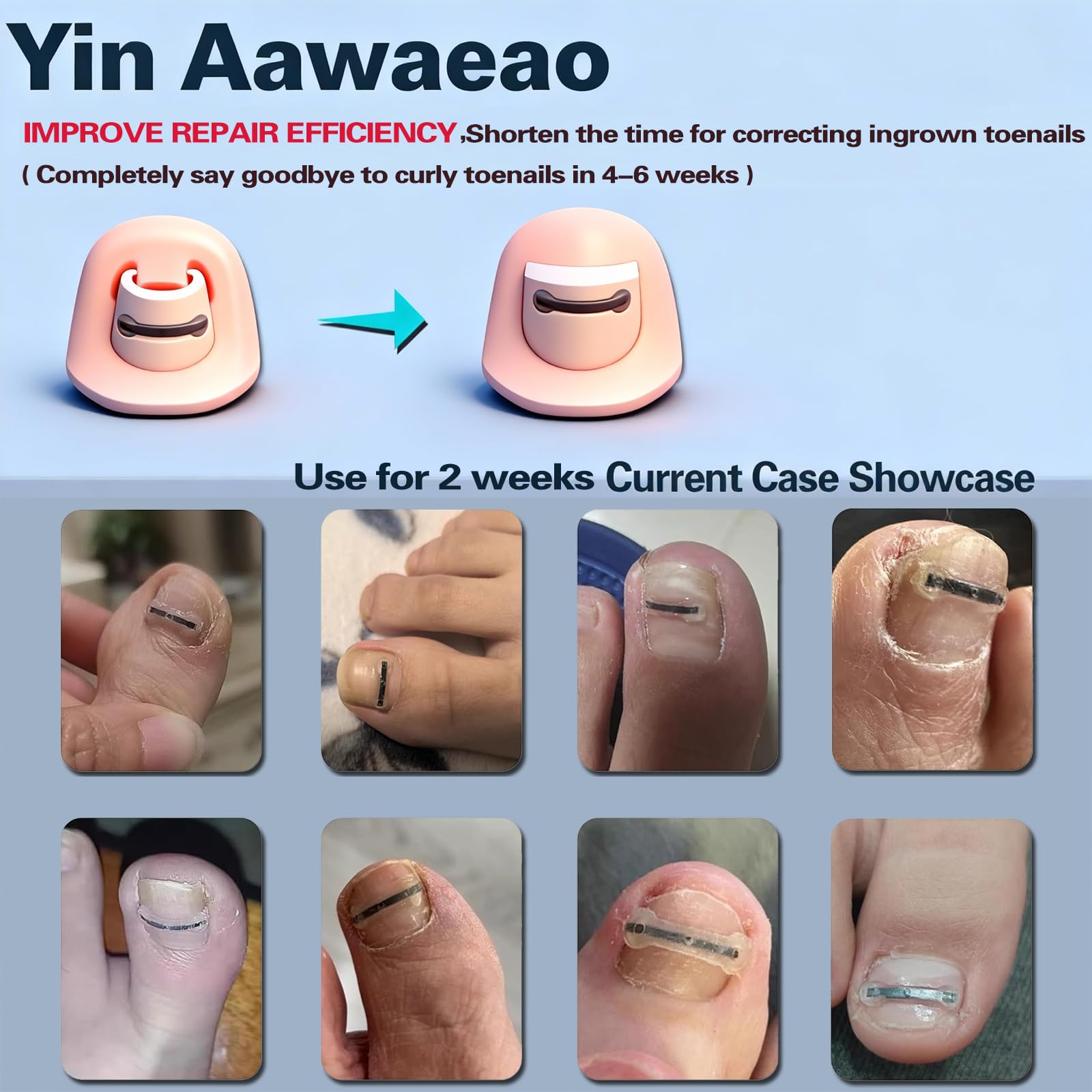 Yin Aawaeao easy-installation tools included for quick setup.