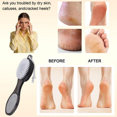 YIOYOODA pumice stone for gentle, effective exfoliation