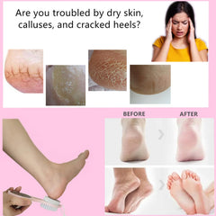 YIOYOODA stainless steel rasp delivers durable, easy-to-clean foot care.