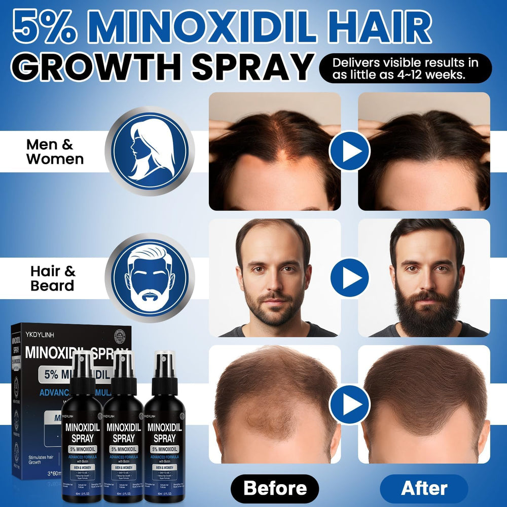 Spray compacto de Minoxidil para viaje y confort