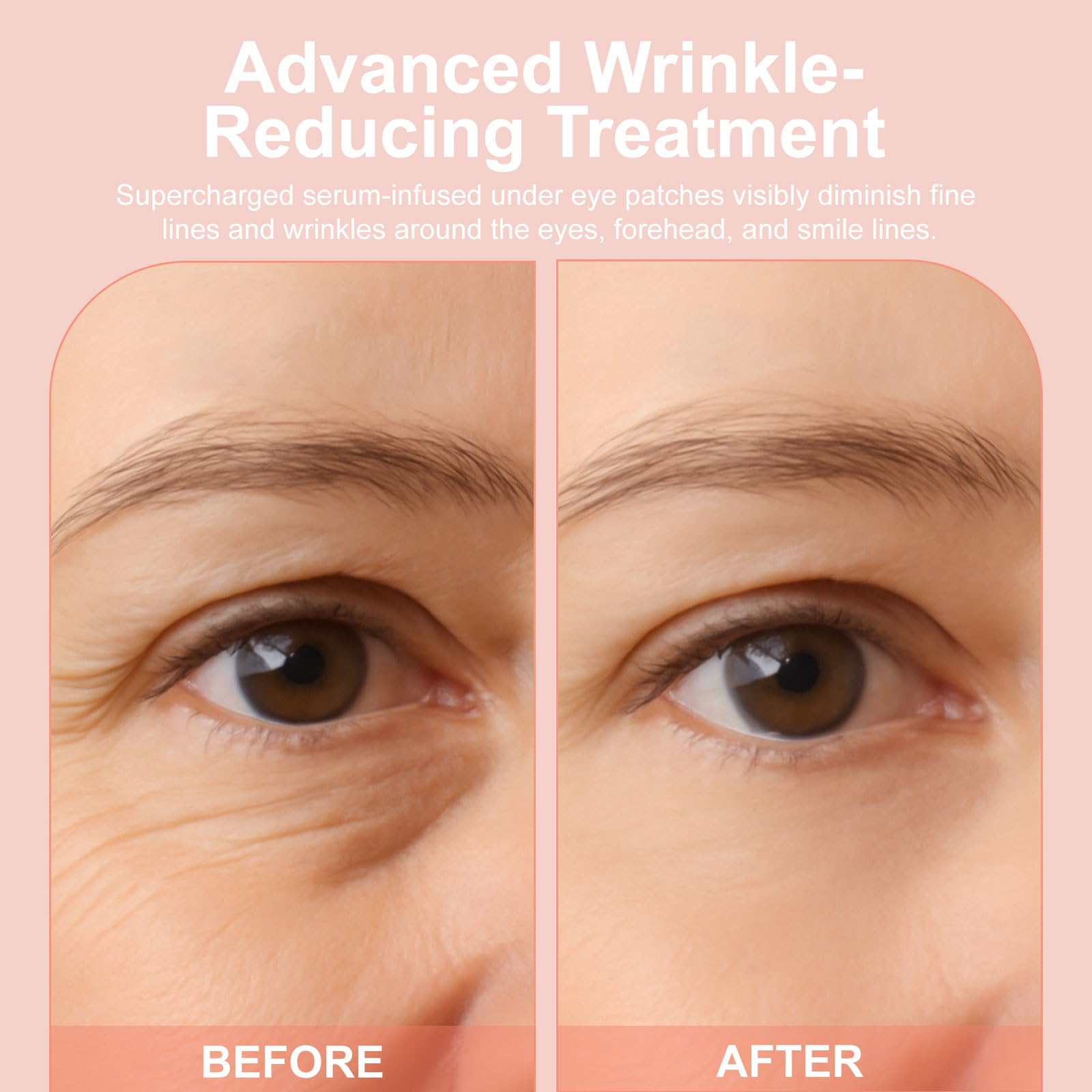 Before and after view from using YLOTRE Novalift patches.