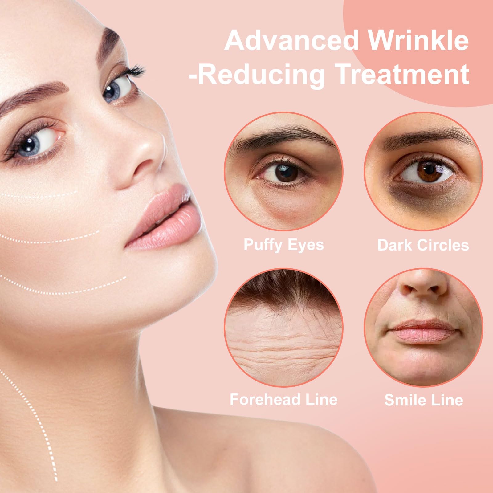 YLOTRE Novalift patches hydrate skin with hyaluronic acid.