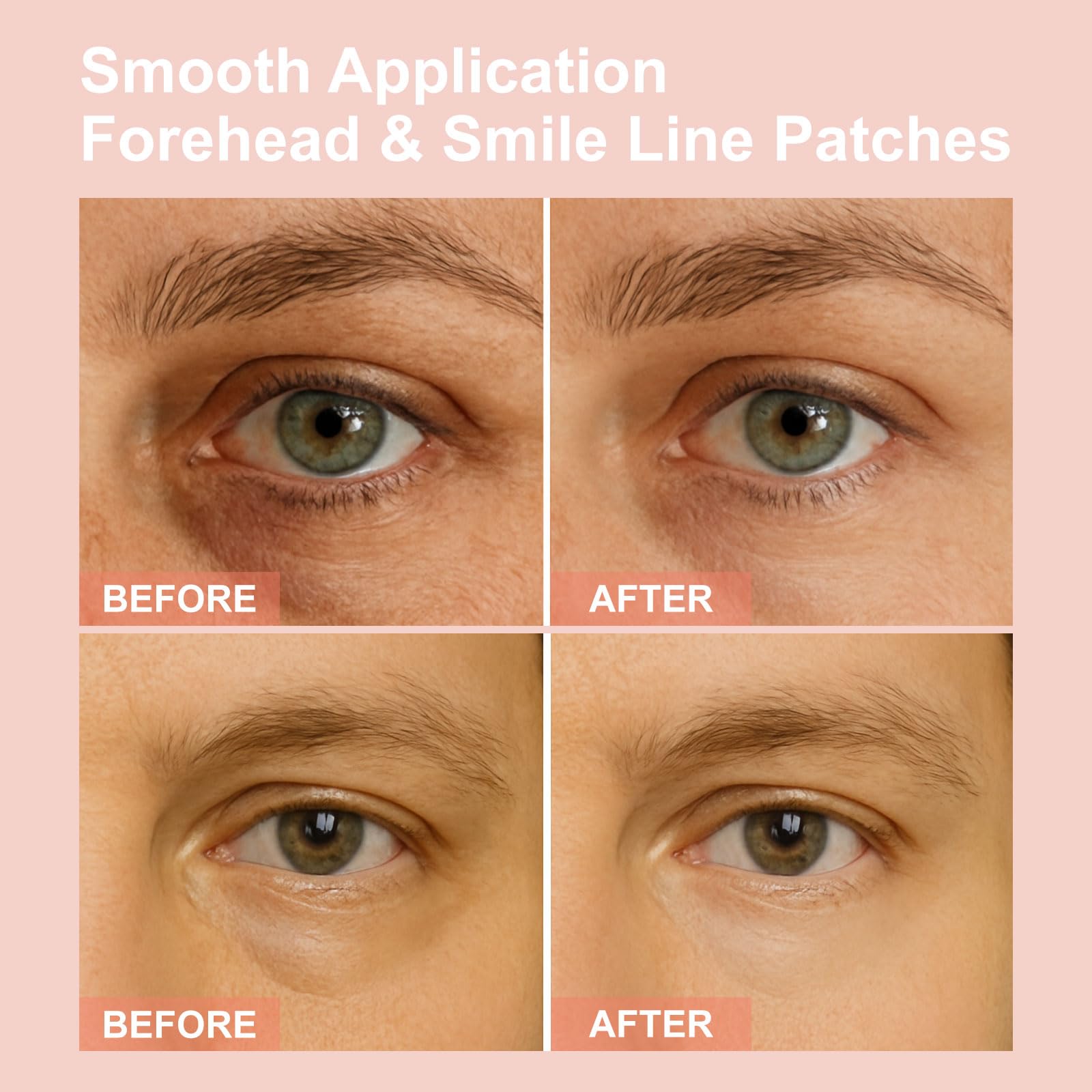 YLOTRE Novalift patches with retinol for subtle wrinkle care.
