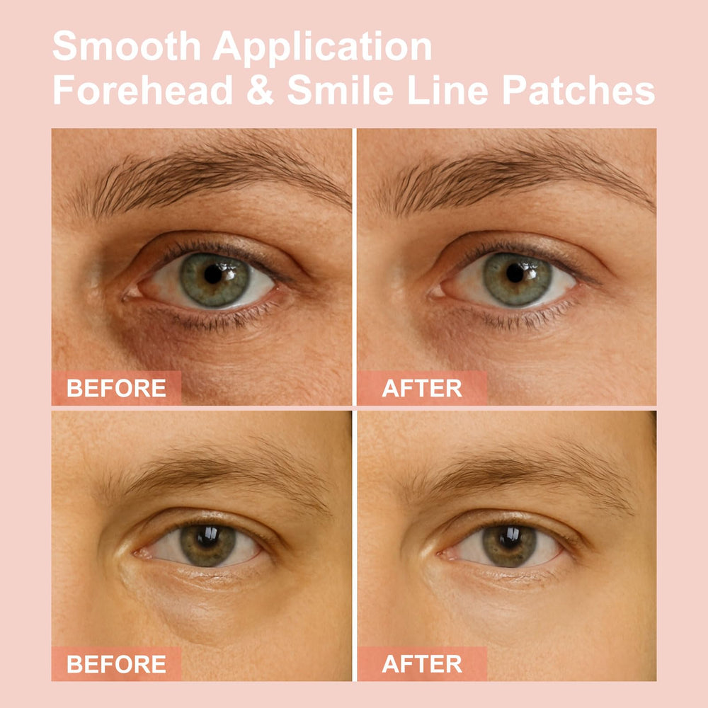 YLOTRE Novalift patches with retinol for subtle wrinkle care.