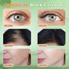 YLXYZUAD Aceite de castor, cabello sano con crecimiento y brillo