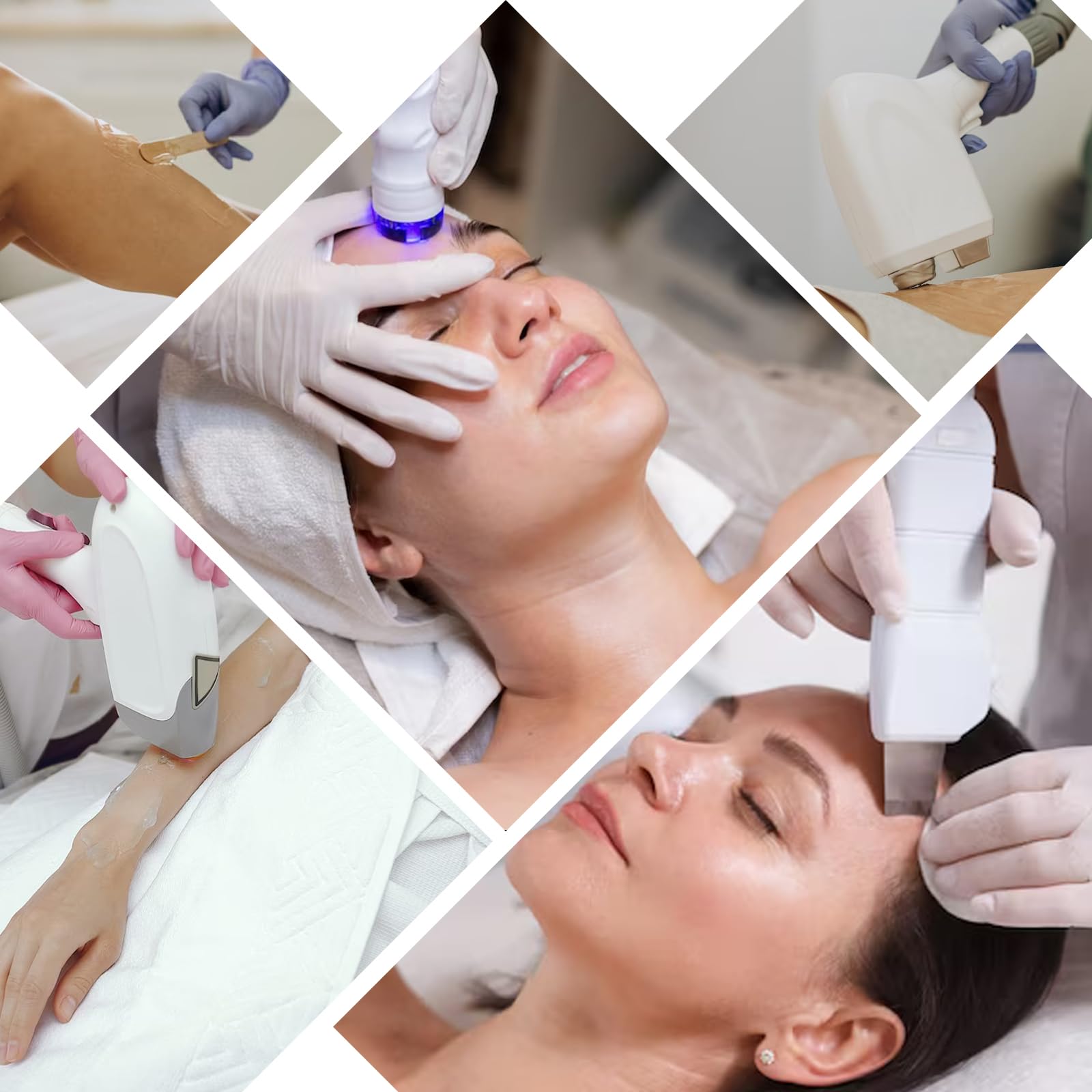 YMEYFAN Gel Conductivo Fácil Limpieza, remover con agua.