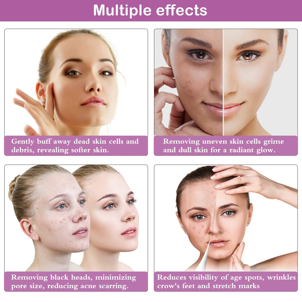 Yofuly skin debris removal close-up highlighting smoother texture.