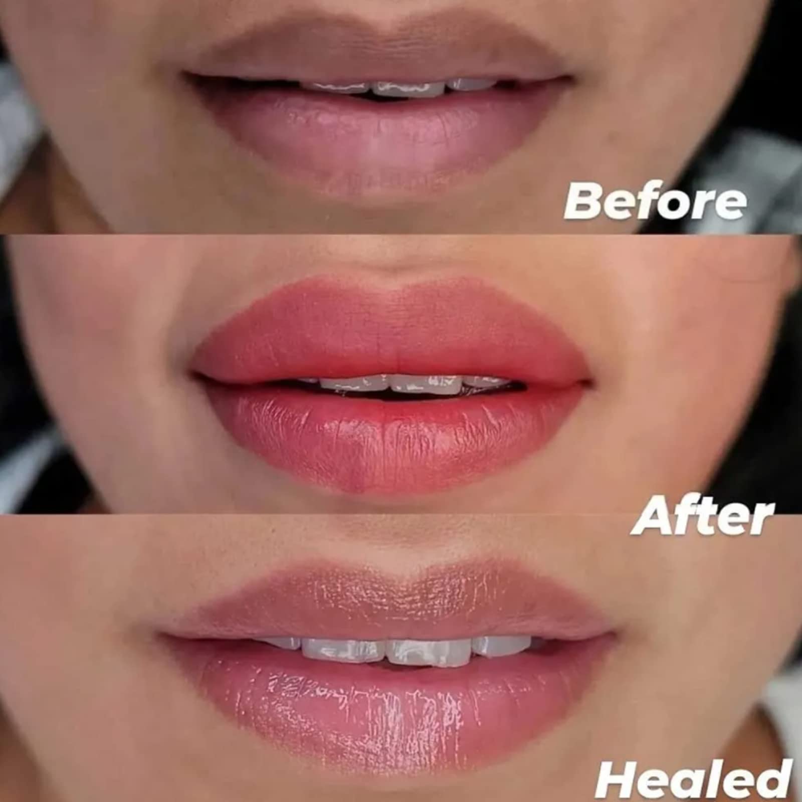 YOUKOOL lip exfoliation tool offers soft bristles for gentle texture refinement.