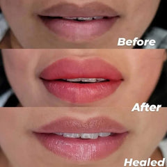 YOUKOOL lip exfoliation tool offers soft bristles for gentle texture refinement.