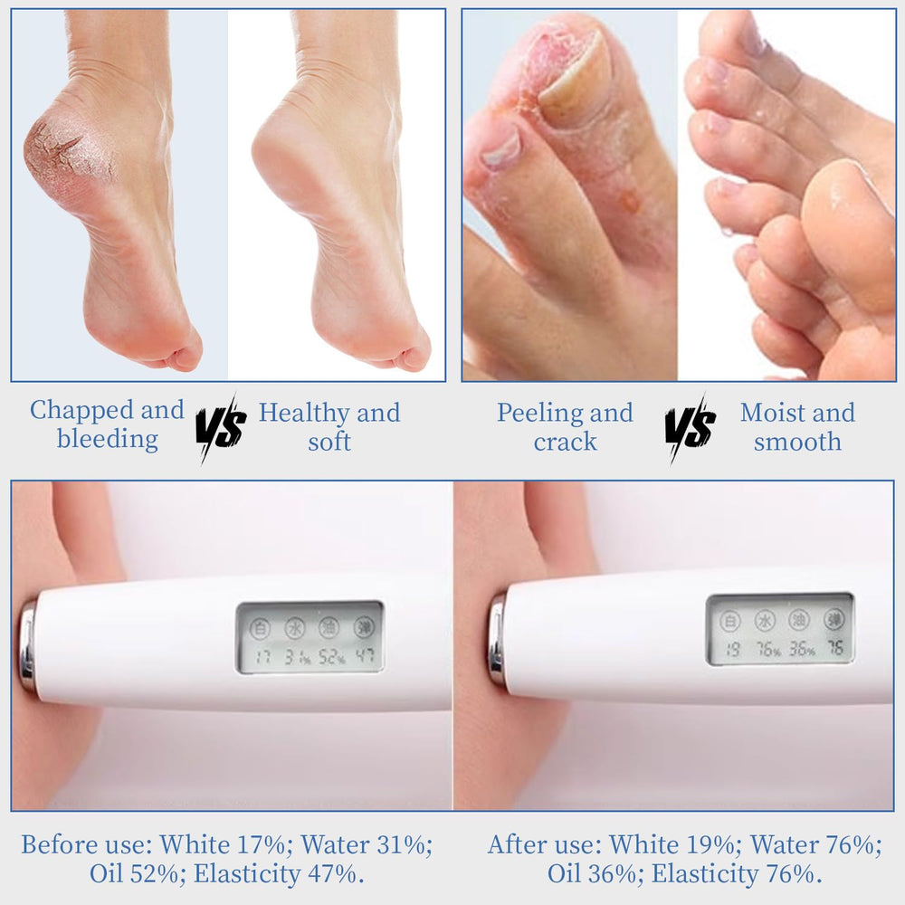 YOUNGYOUNGLOVE crema de urea 70% con aroma fresco, sensación de limpieza