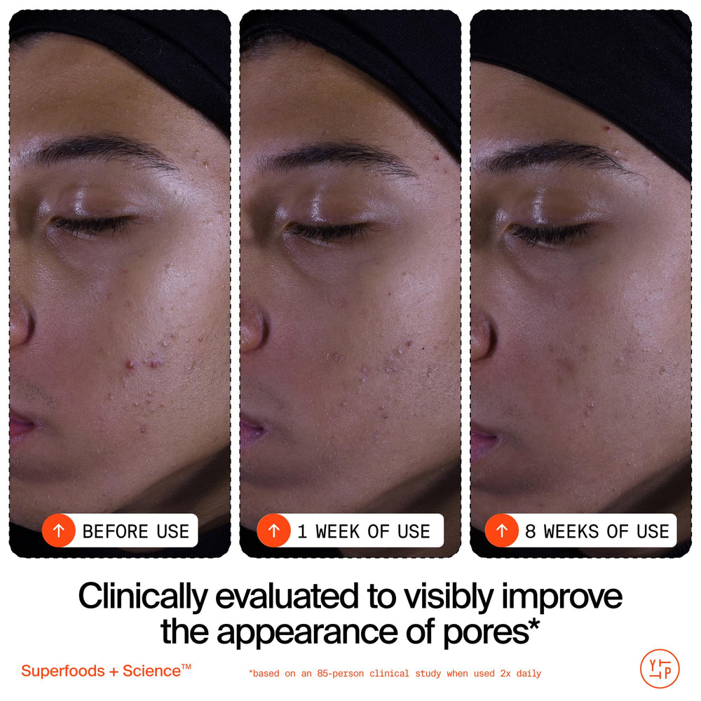 Youth To The People Superfruit Cleanser vitamin C label signals brightening potential