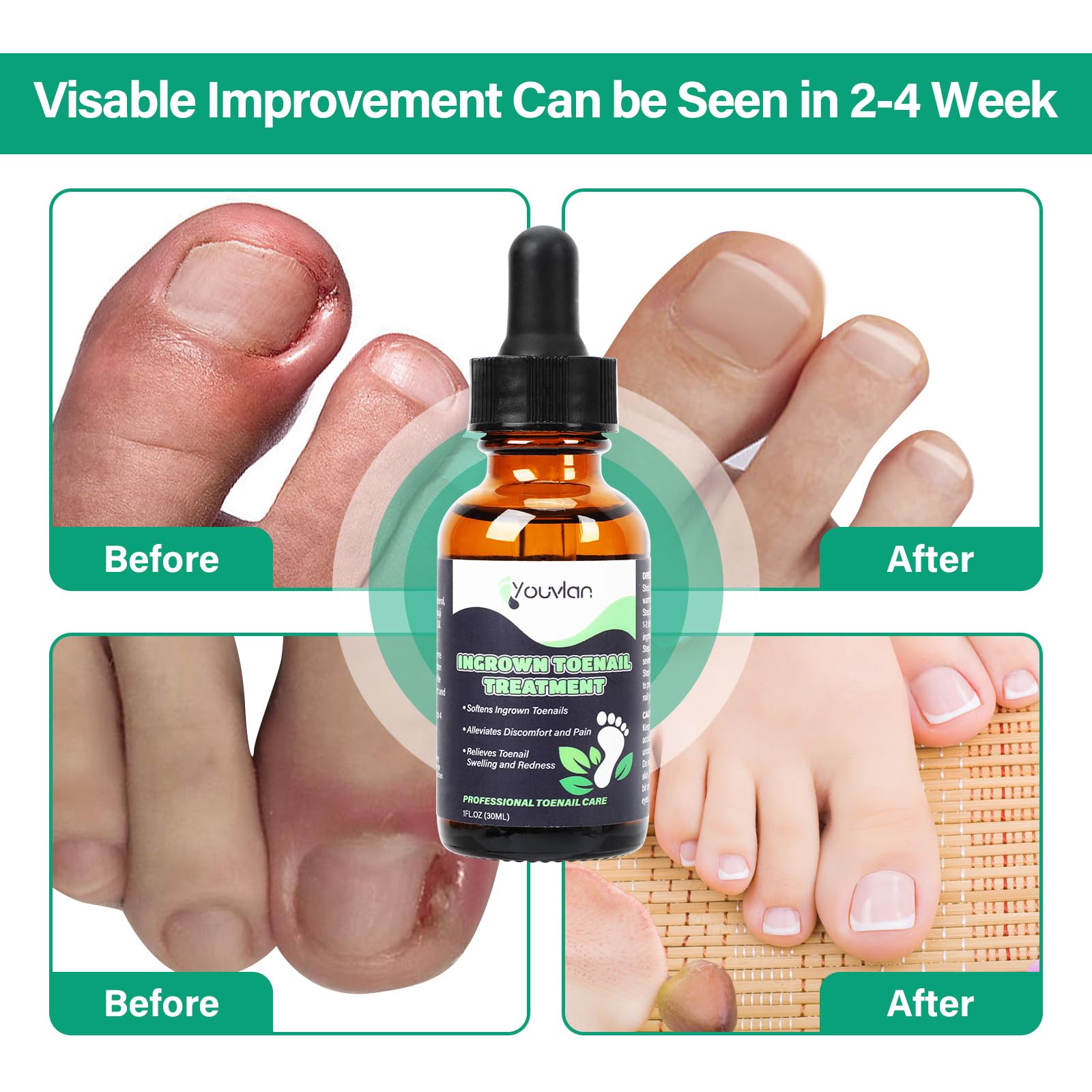 YOUVLAN at-home-use guide supports daily nail care routine