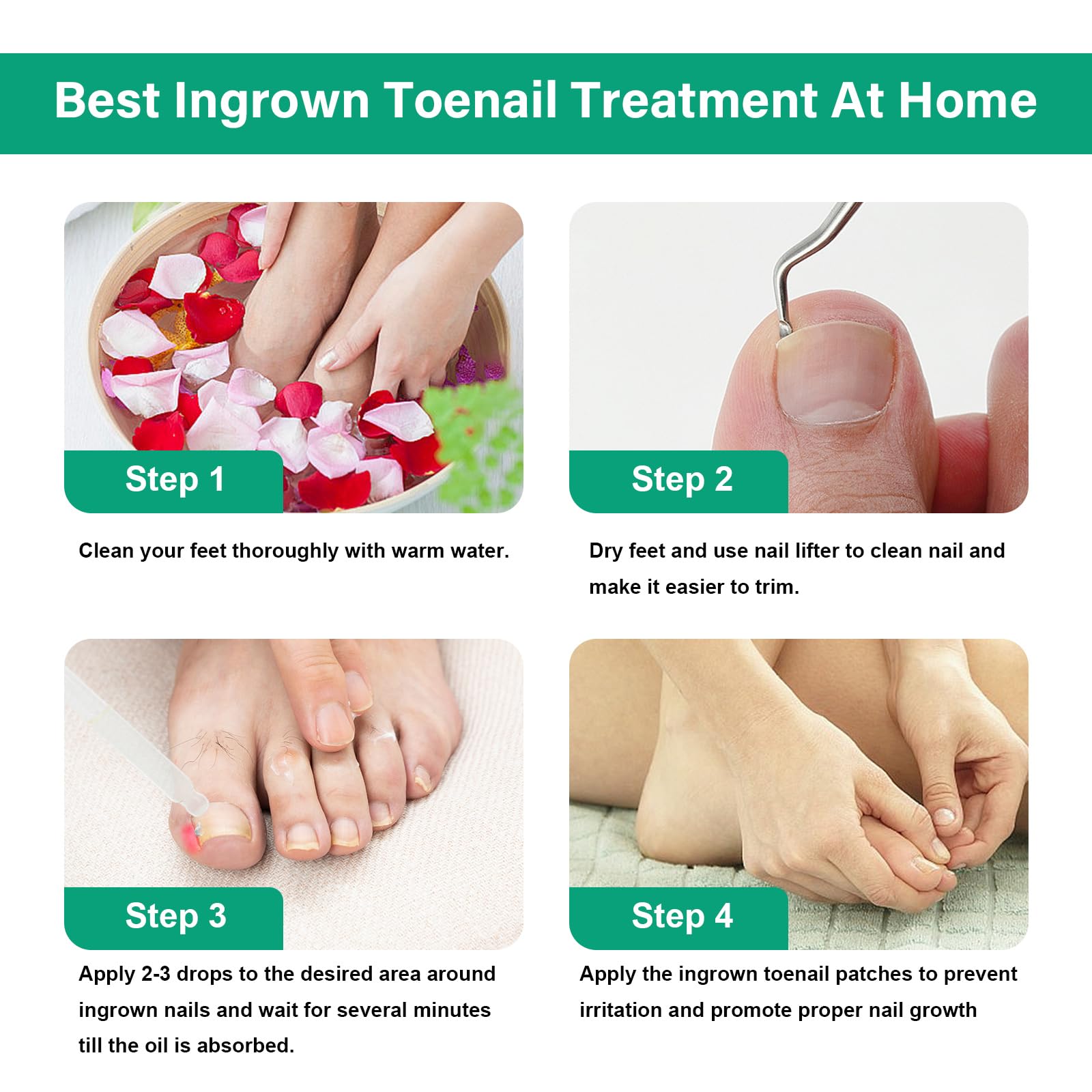 YOUVLAN nail separator tool eases alignment during treatment