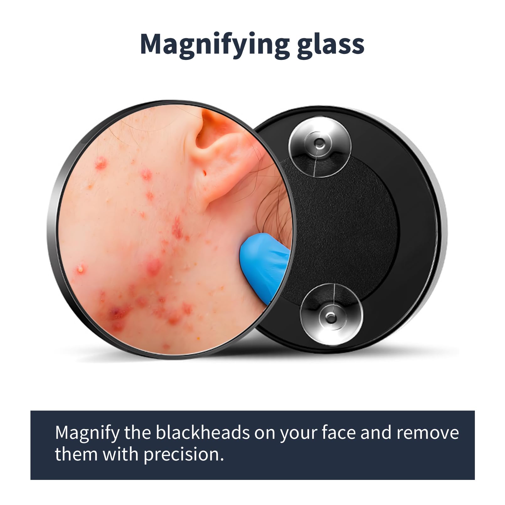 YOUYISI zit popper tool targets stubborn spots with control.