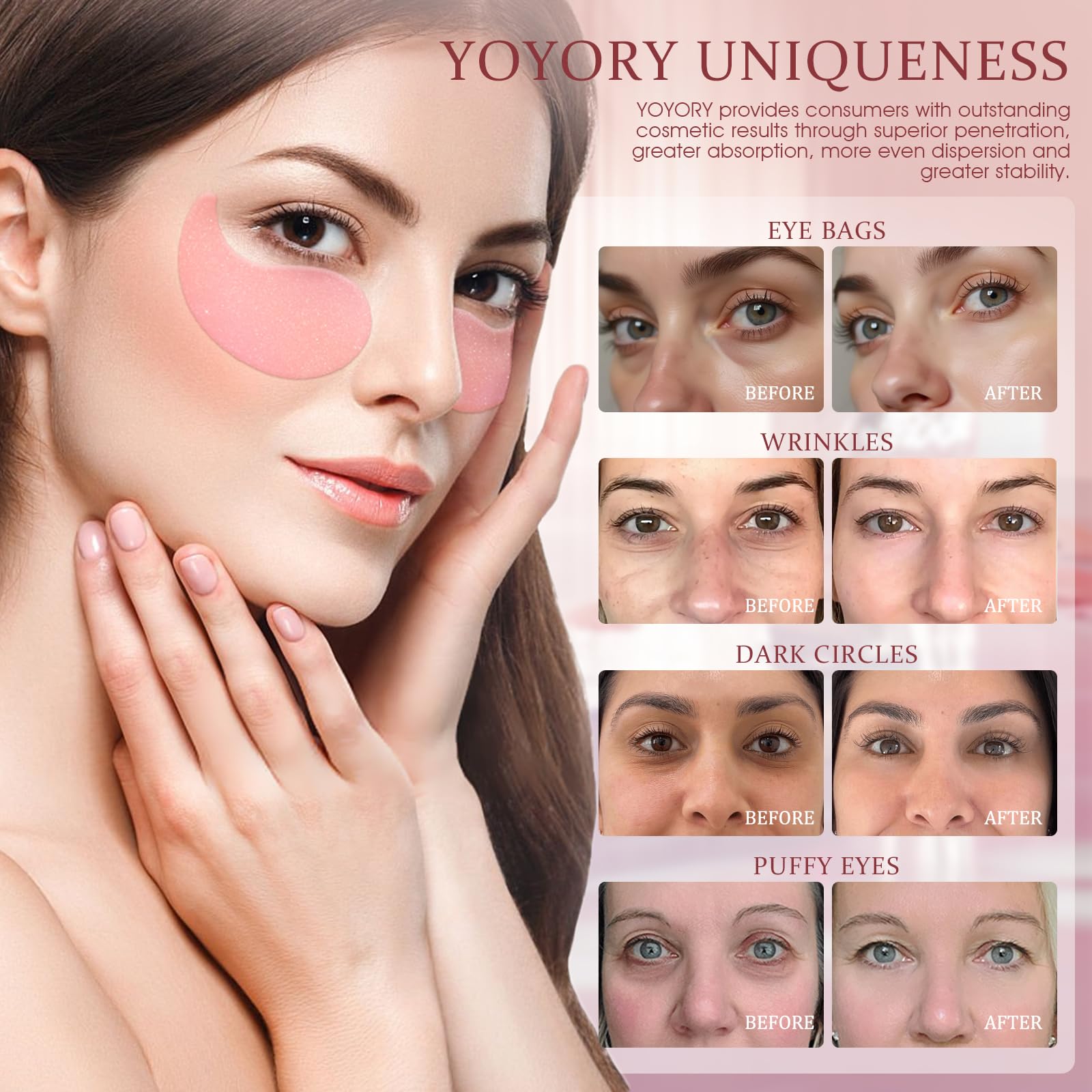 YOYORY pink hydrogel patches adhere securely for a cooling, no-slip treatment.