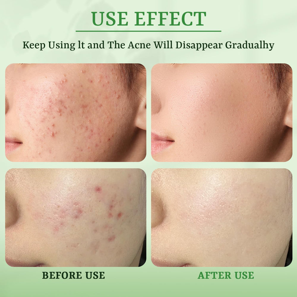 After use, skin appears refreshed with balanced moisture.