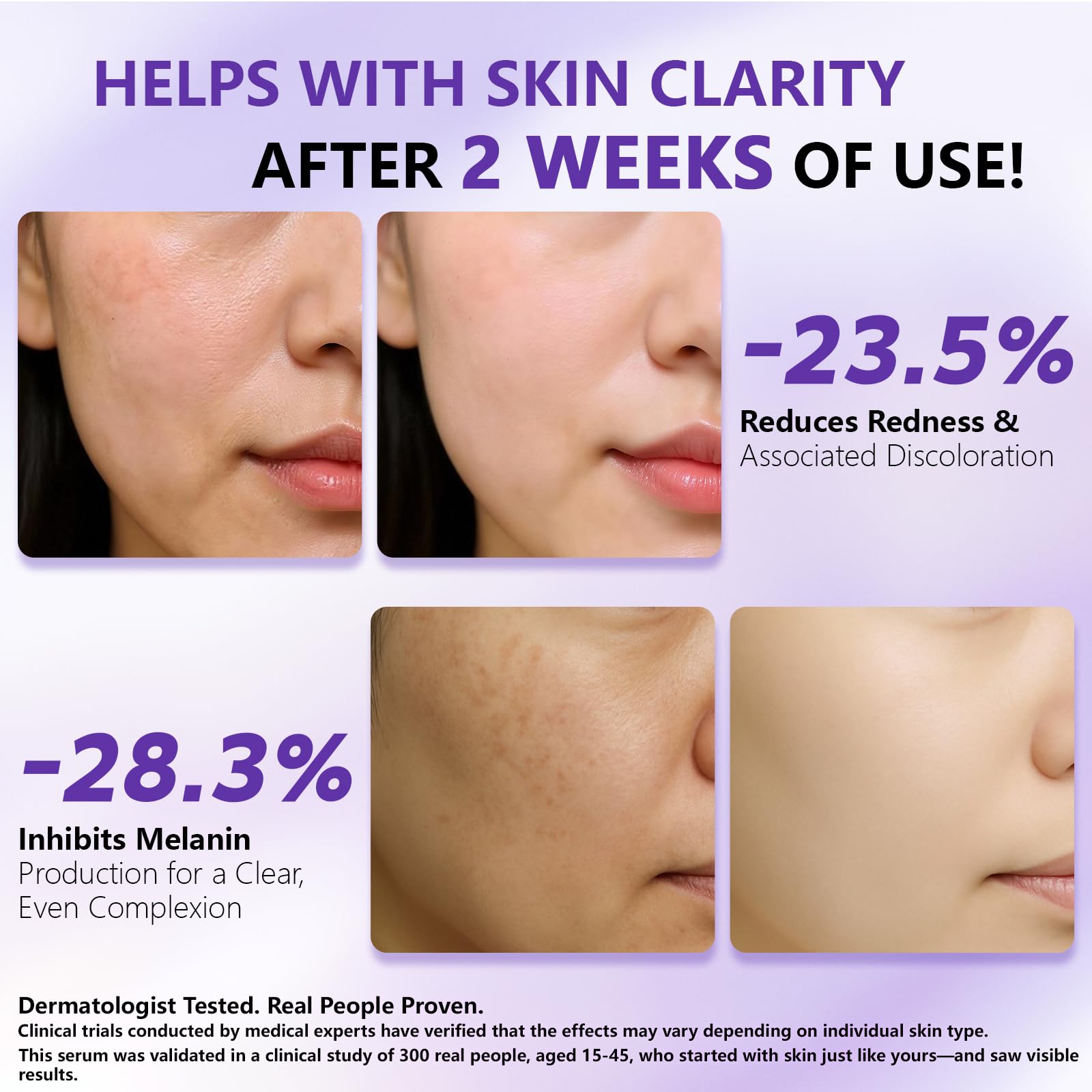 YUFUY serum control de sebo para poros más finos