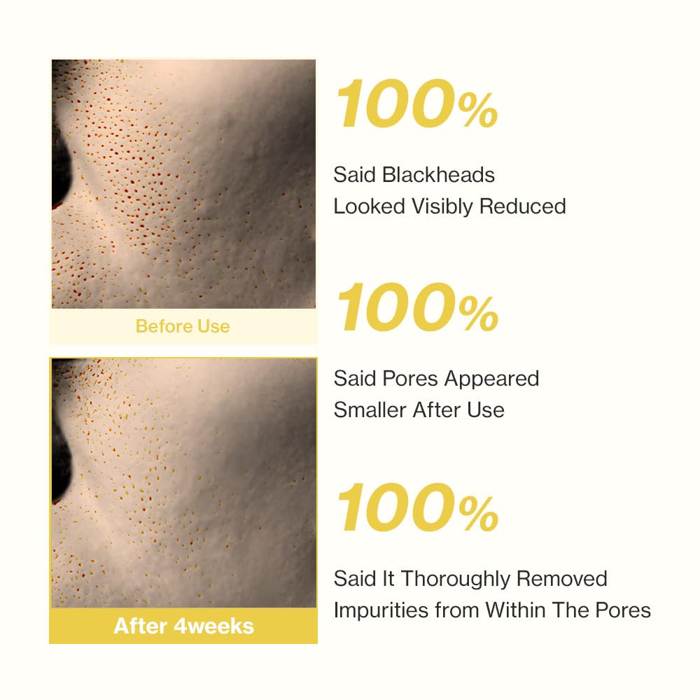 YUMU Aceite de semilla de Coix: nutrientes suaves para equilibrio cutáneo.